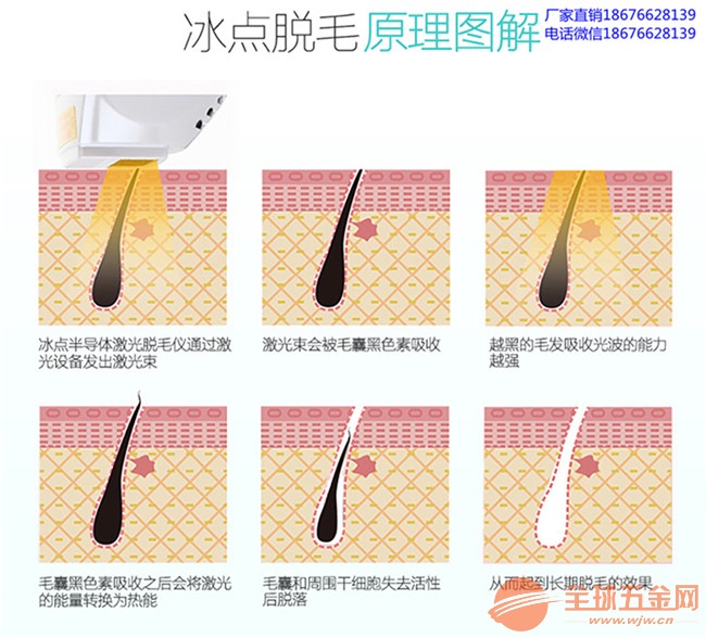 激光脱毛多少钱一台 IMG190315141427034126.jpg